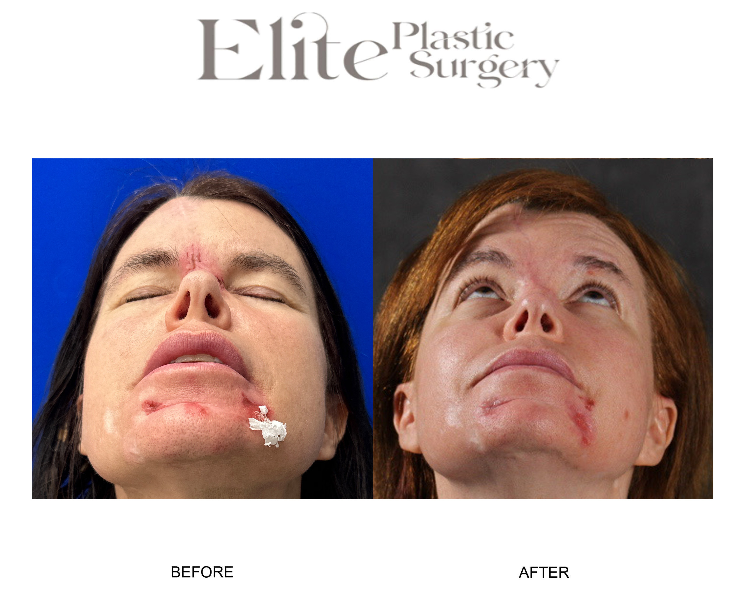 Facial Reconstruction Before & After Gallery - Patient 291811 - Image 2